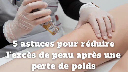 5 astuces pour réduire l’excès de peau après une perte de poids