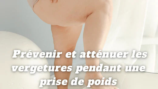Comment prévenir et atténuer les vergetures pendant une prise de poids ?